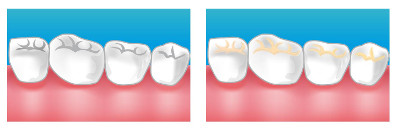 soins dentaire dentiste blanc mesnil